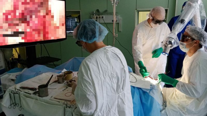 Воронежской врачи провели первую операцию мозга на уникальном оборудовании