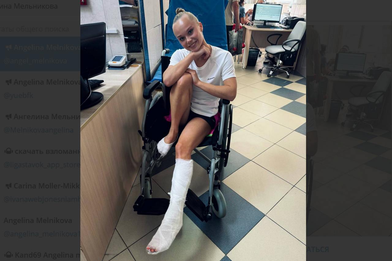Воронежская гимнастка Ангелина Мельникова назвала точный диагноз травмы ноги