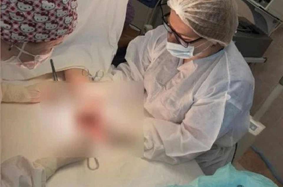 Отрезанную пилой кисть пришили пациенту воронежские хирурги