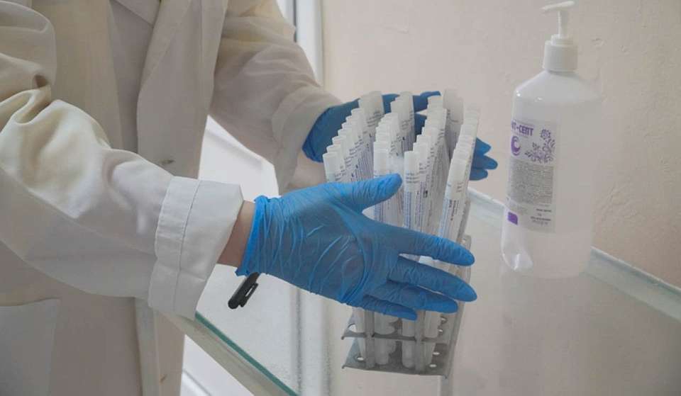 Выяснилось число болеющих ВИЧ воронежцев