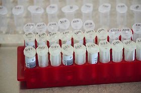 У 234 воронежцев выявили коронавирус за сутки 