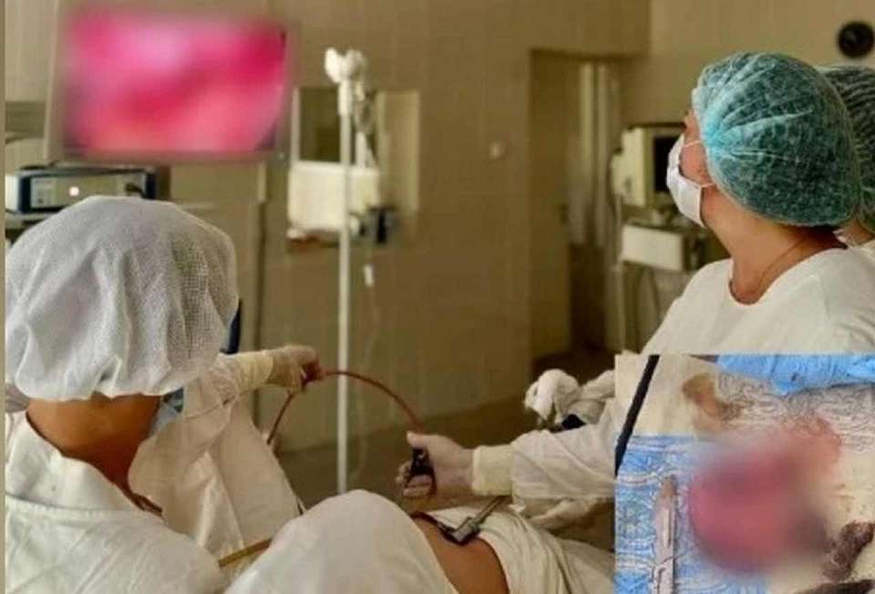 Воронежские врачи удалили у 42-летней пациентки 12-саниметровую эмбрионально-клеточную опухоль