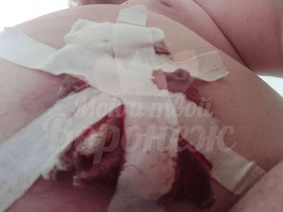 Ранения в живот и ногу после стрельбы из-за парковки получил воронежец